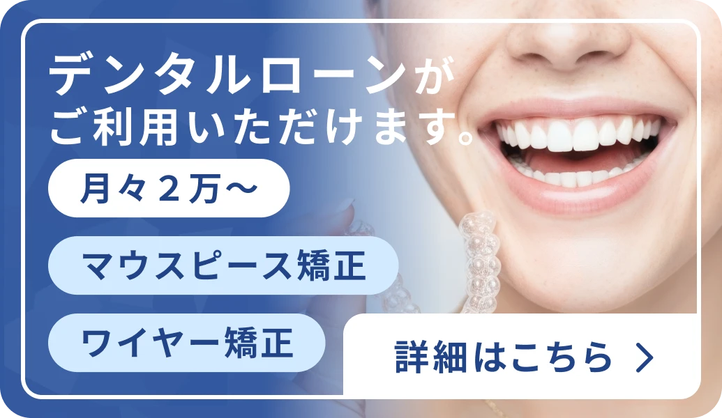 マウスピース矯正・ワイヤー矯正のデンタルローン（月々2万円〜）のご案内バナー（スマートフォン用）