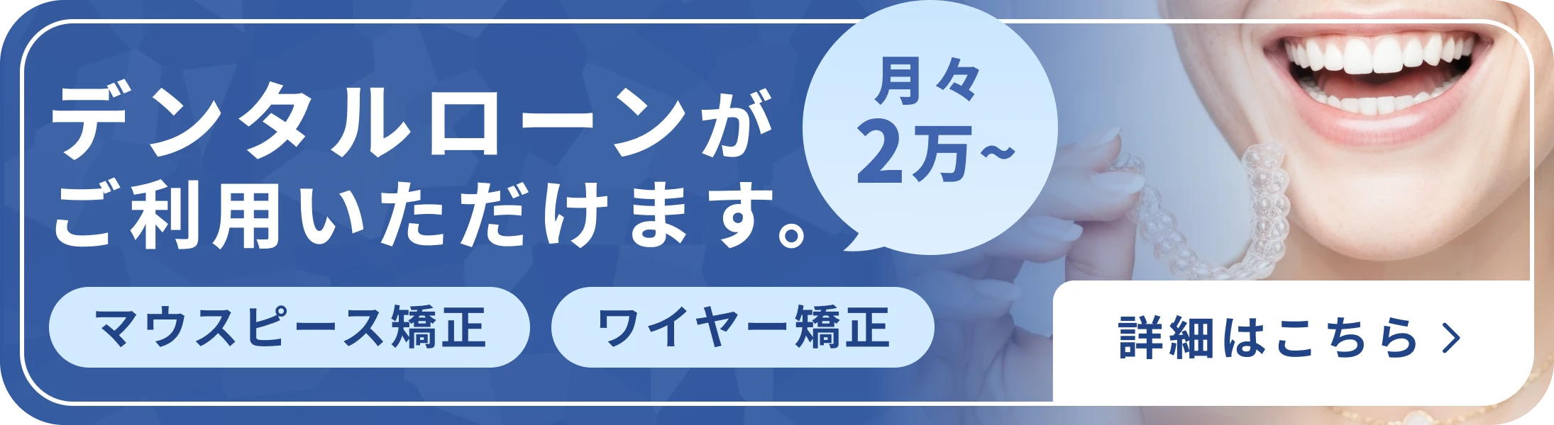 マウスピース矯正・ワイヤー矯正のデンタルローン（月々2万円〜）のご案内バナー